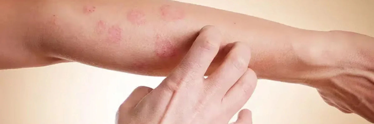 Problemas de la piel